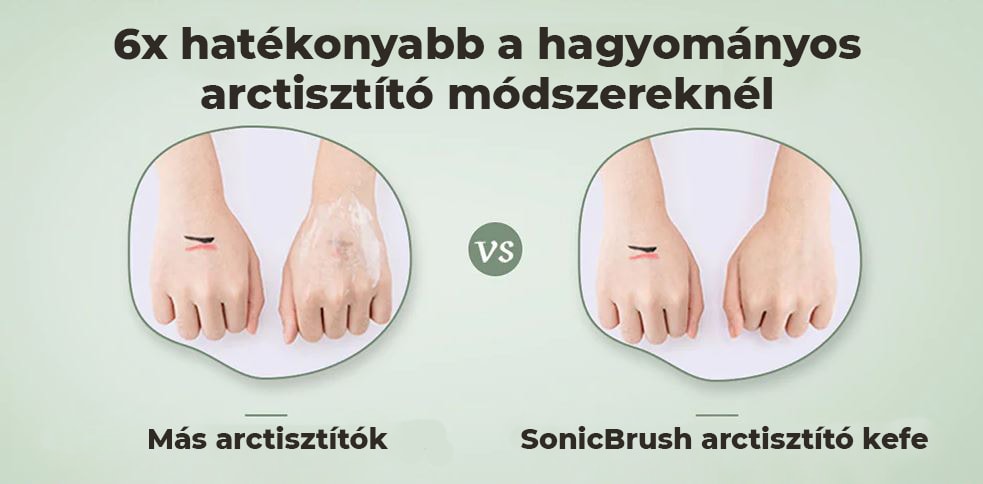 SonicBrush četka za čišćenje lica